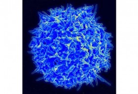 CAR-T免疫疗法只用一剂就能攻击小鼠的卵巢癌
